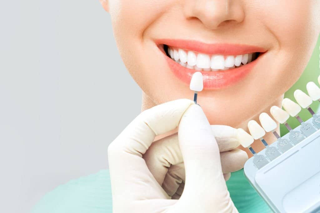 Zahnkronen 4 Holy Dental Zahnkronen 1 2